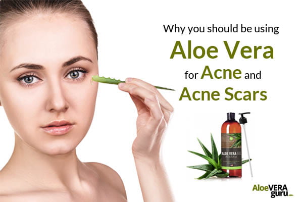 Why You Should Be Using Aloe Vera for Acne and Acne Scars - Featured Image