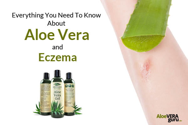 Aloe vera for eczema - featured image